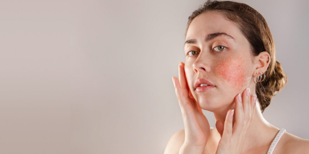 girl with red spots on her cheeks