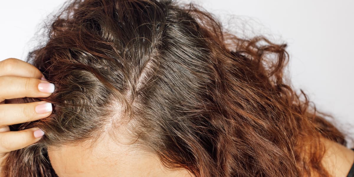 Smelly Scalp Tips On Getting Rid Of Stinky Scalp Smell