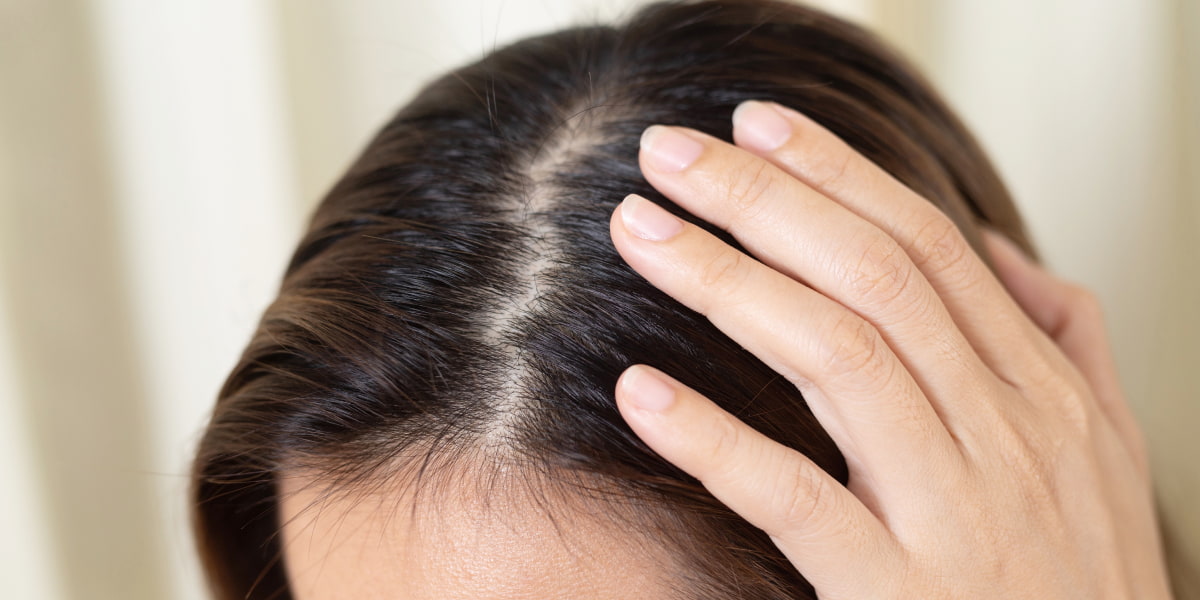 How To Get Rid Of Greasy Hair Fast Oily Hair Causes And Healing