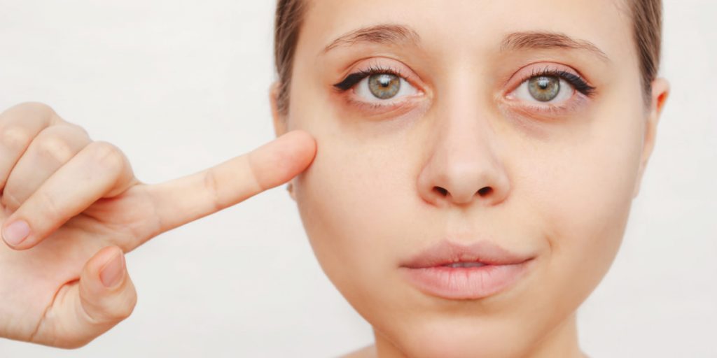 4. Remove Dark Circles Under The Eyes 1024x512 - How To Make Your Eyes Look Bigger? Use These 12 Foolproof Methods