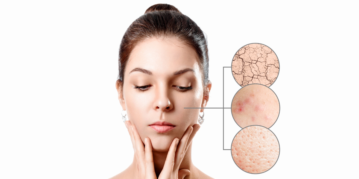 How Does Salicylic Acid Work? What Are Its Benefits For Skin?