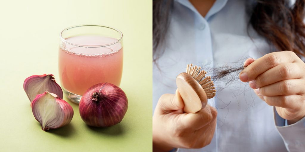 onion juice to prevent hair loss
