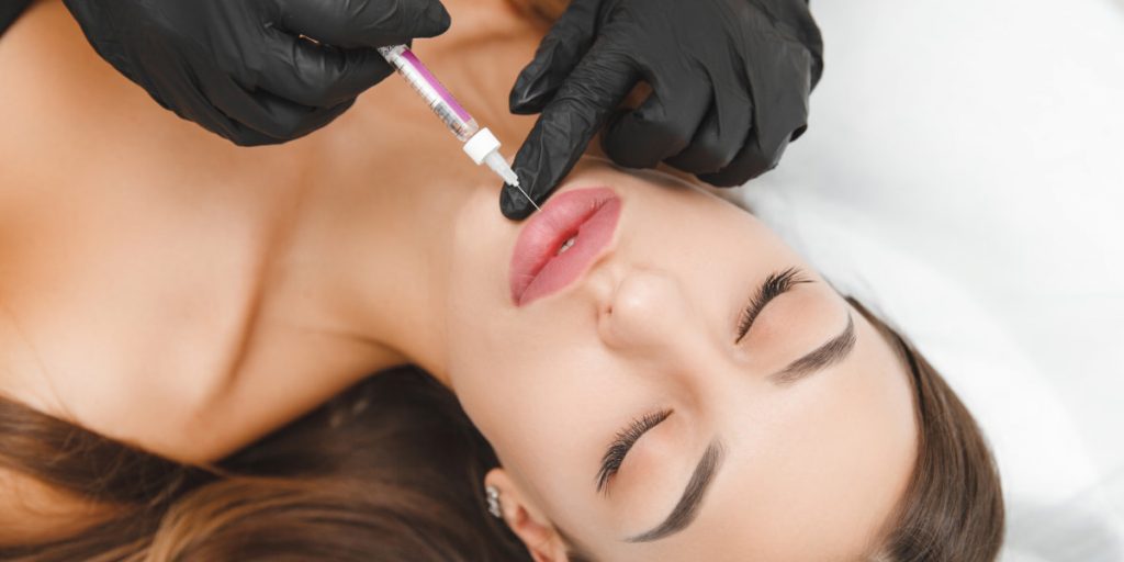 lip augmentation with fillers