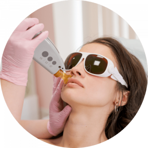 9 Laser Hair Removal min 300x300 - How To Remove Hair On The Upper Lip: 8 Methods You Didn’t Expect!